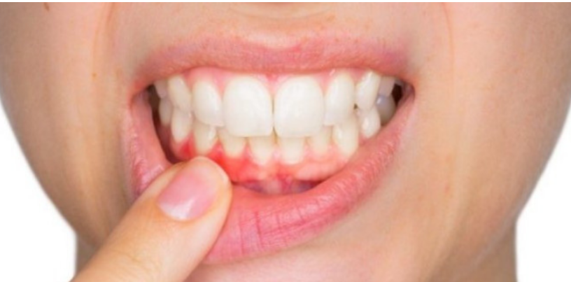dental hygiene and gum care